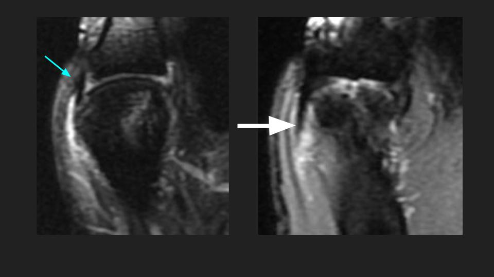 Figure 2 for case sprain ( RID4731 )